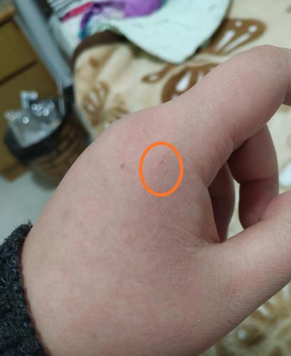 家養的寵物?家養的寵物貓抓破皮要打針嗎!